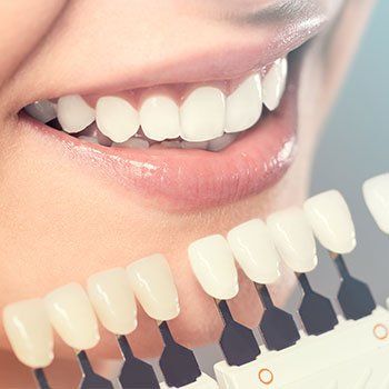 Dental Implants — Whitening Crowns in Louisville, Kentucky Dental Implants — Whitening Crowns in Louisville, Kentucky
