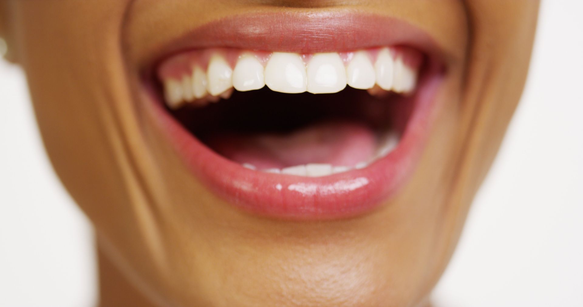 Healthy teeth with a happy smile