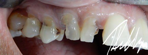 before image patient number six