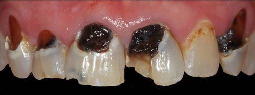 before image patient number three
