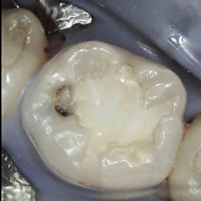 before image patient number two