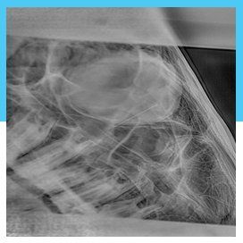 X-ray