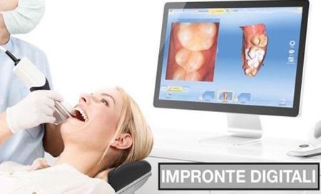 immagine rx denti