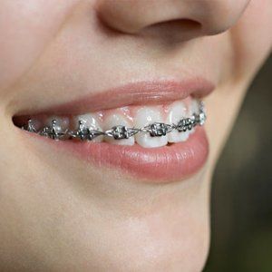 orthodontics treatment