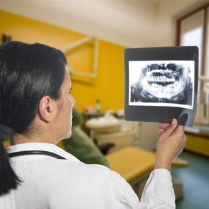 Dental cone beam technology