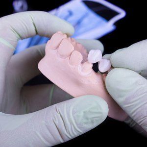 Dental crowning