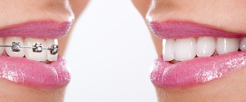Orthodontic specialists