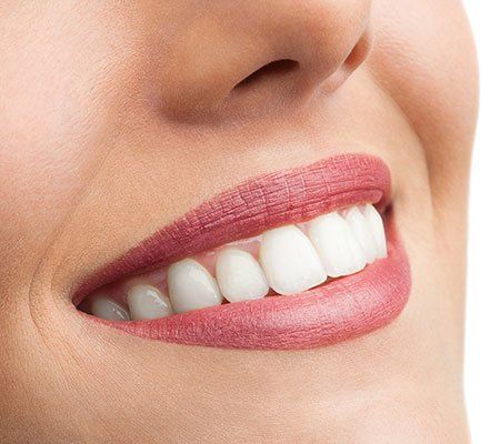 Teeth Whitening — Close up of Perfect Teeth in Tenafly, NJ Teeth Whitening — Close up of Perfect Teeth in Tenafly, NJ