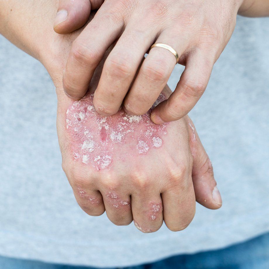 dry itchy skin on hand
