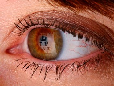 Dr. Douglas H. Lanning — Dry Eyes in Eureka, CA Dr. Douglas H. Lanning — Dry Eyes in Eureka, CA