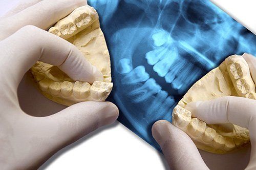 Dental samples and X-rays of patient