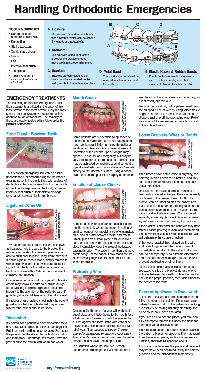 How to Handle Orthodontic Emergencies