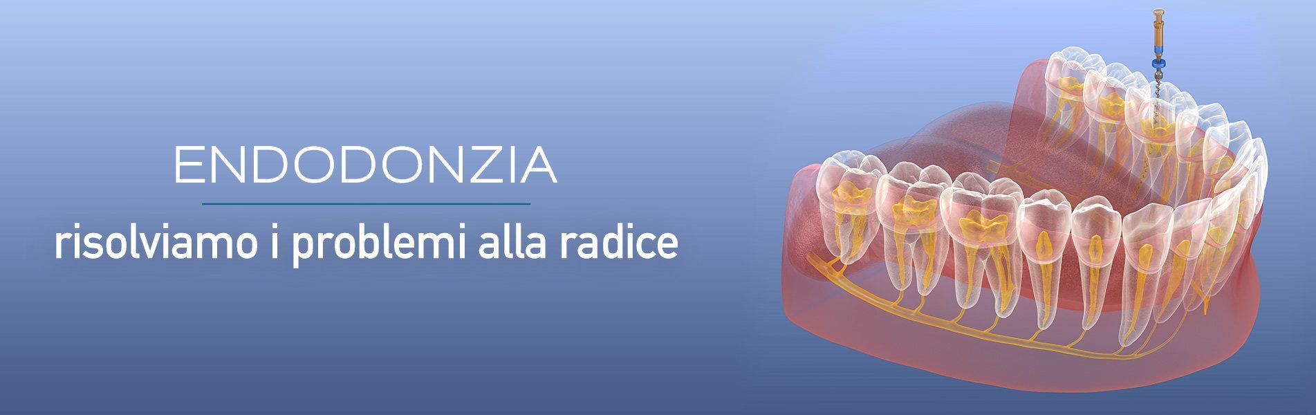 endodonzia