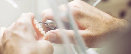 hands repairing dentures