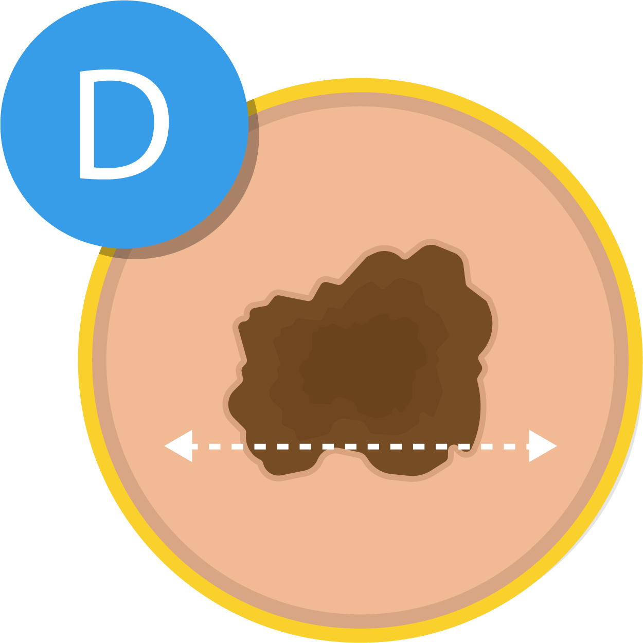 Skin Cancer Graphic