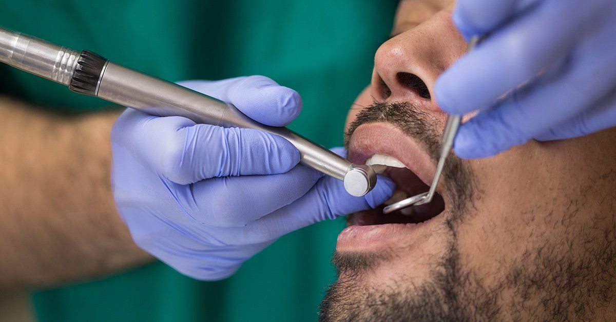 dental deep cleaning