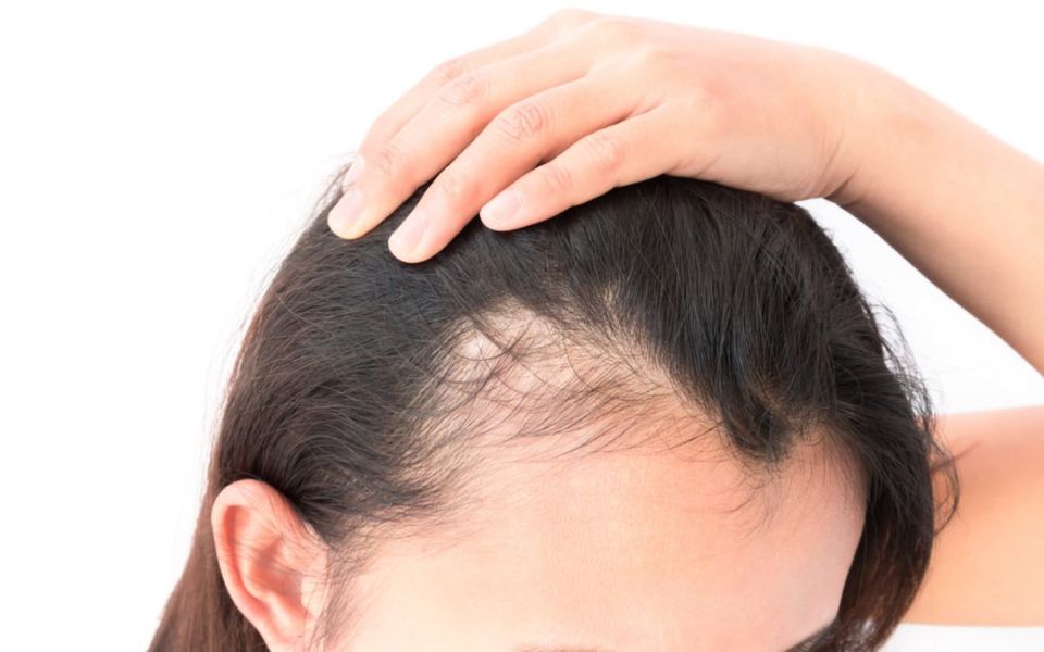 thinning hair treatment