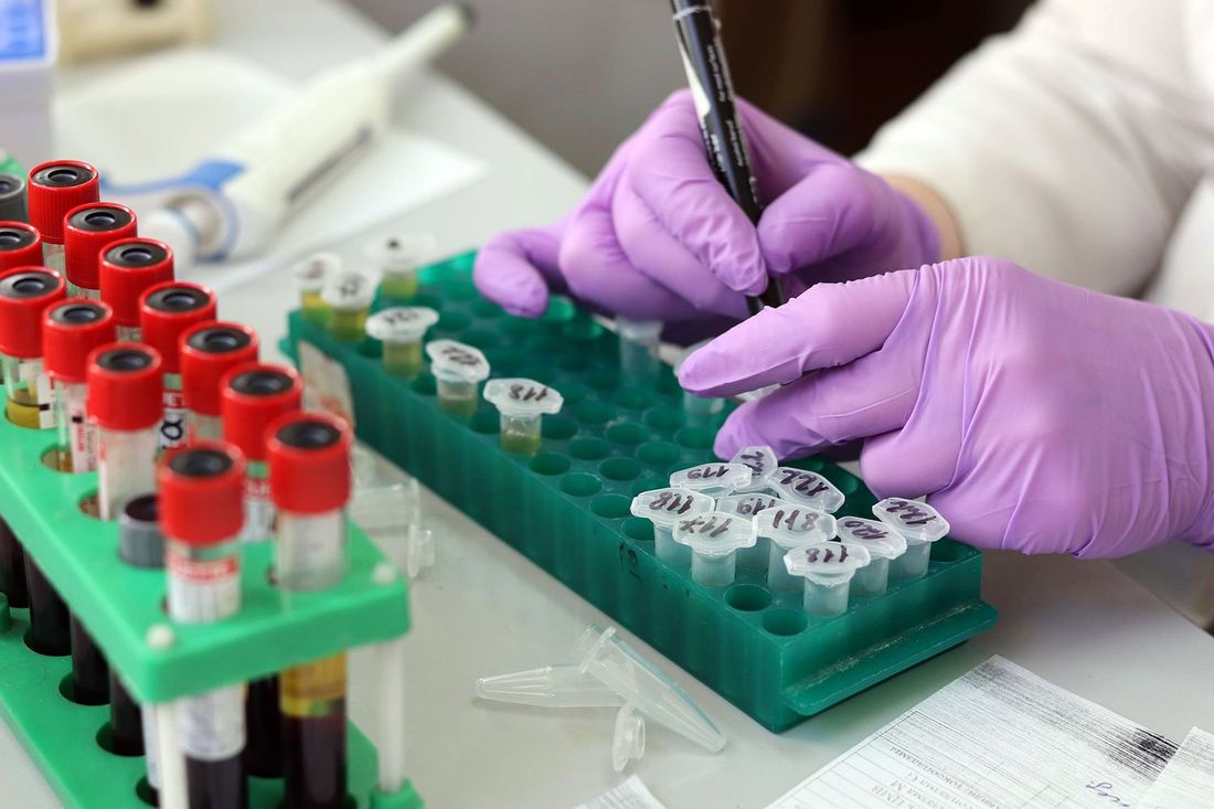 Campioni per esami allergologici