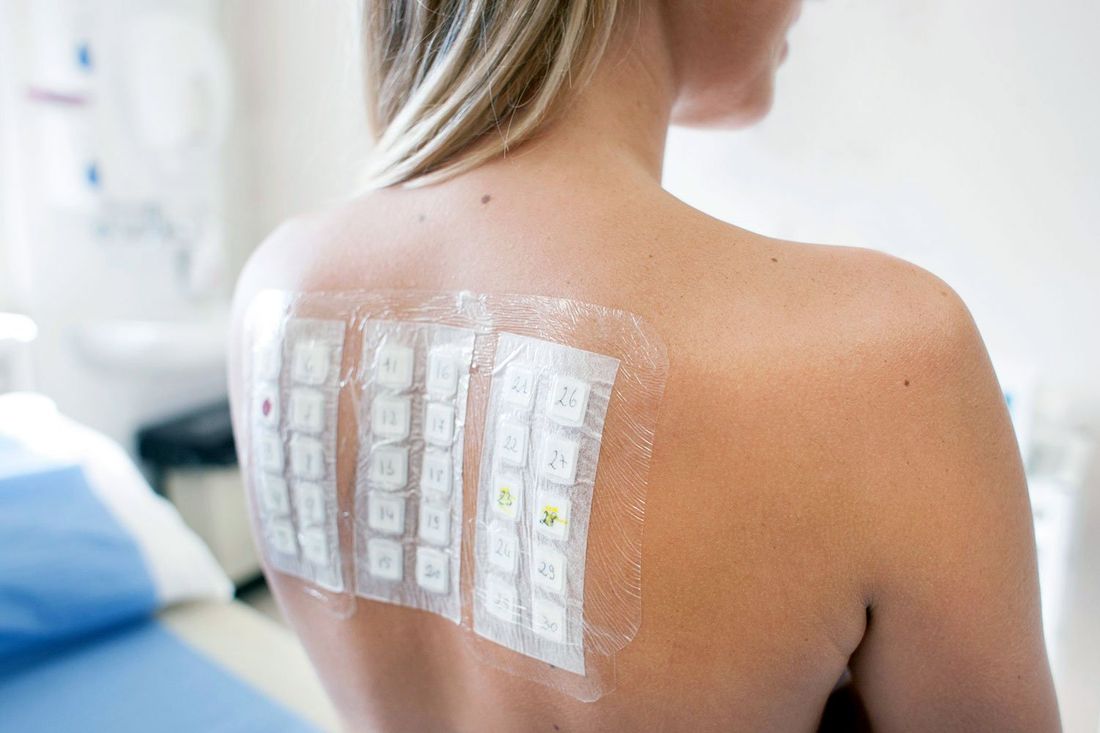 Prick test per allergeni