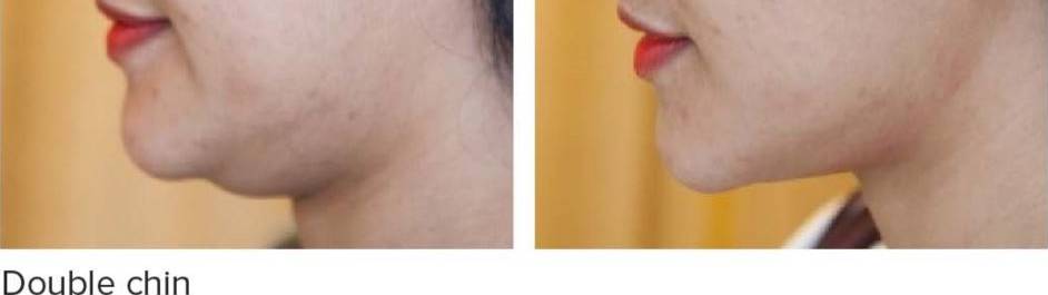 Sydney ENT & Advanced Hearing | Hurstville  NSW