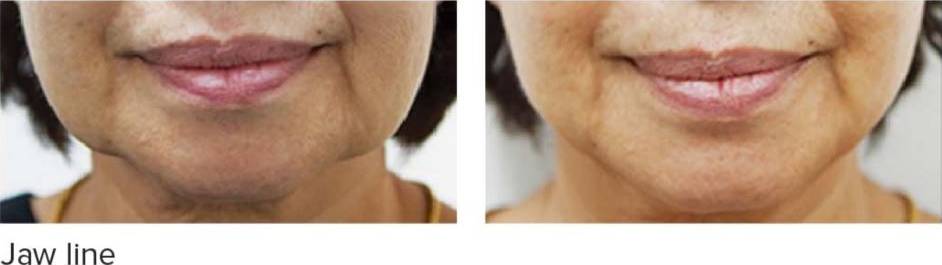 Sydney ENT & Advanced Hearing | Hurstville  NSW