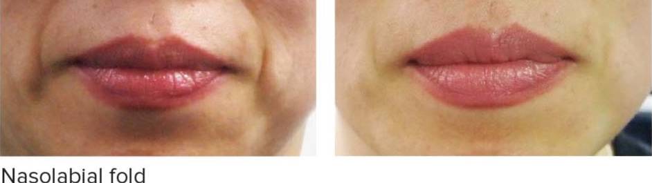 Sydney ENT & Advanced Hearing | Hurstville  NSW