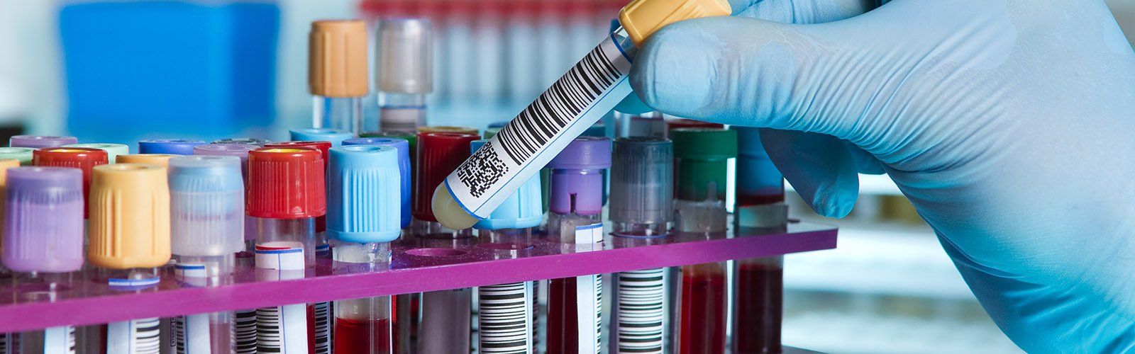 Analisi del sangue alla clinica ad Altopascio
