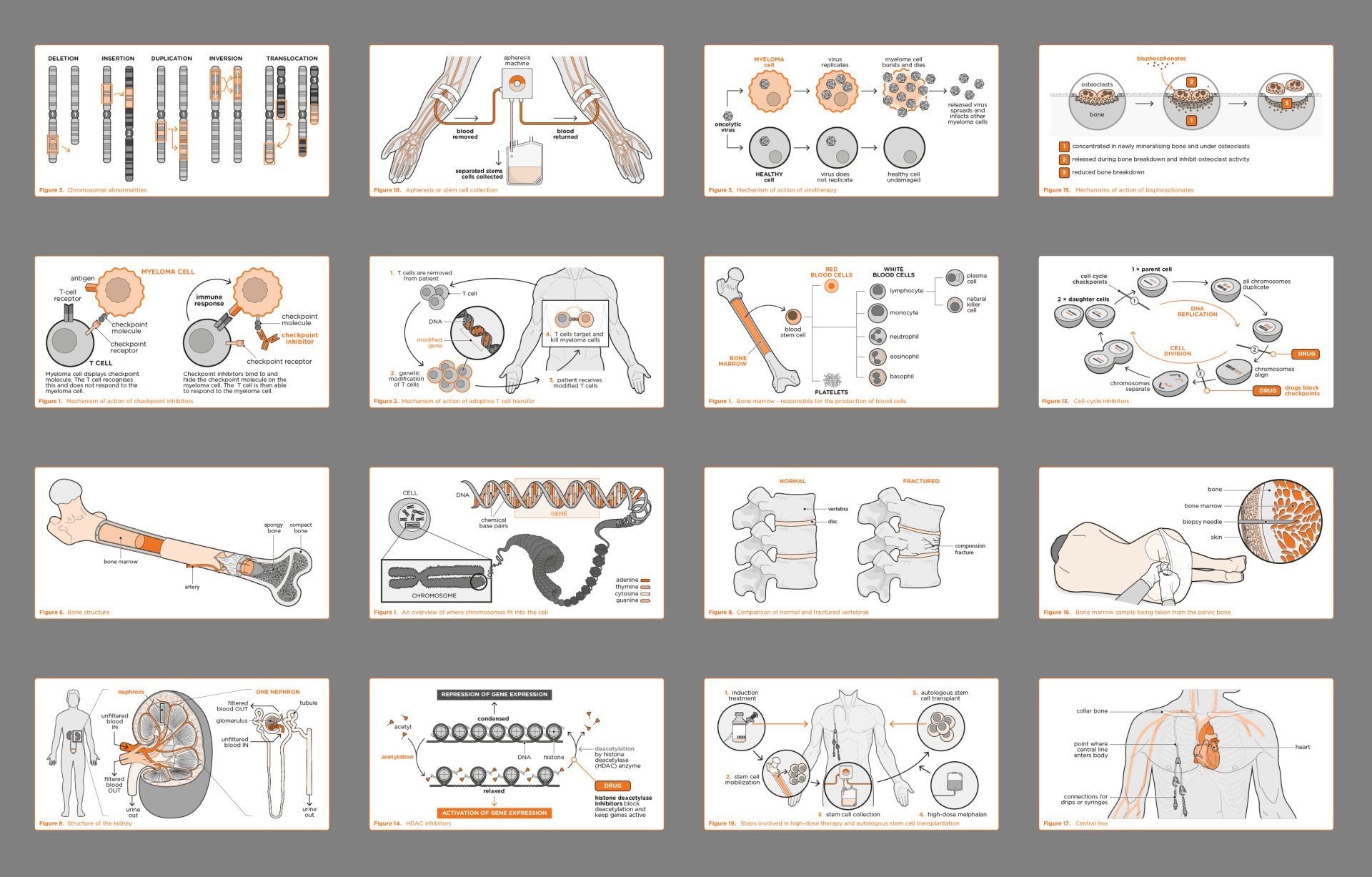 Myeloma illustrations