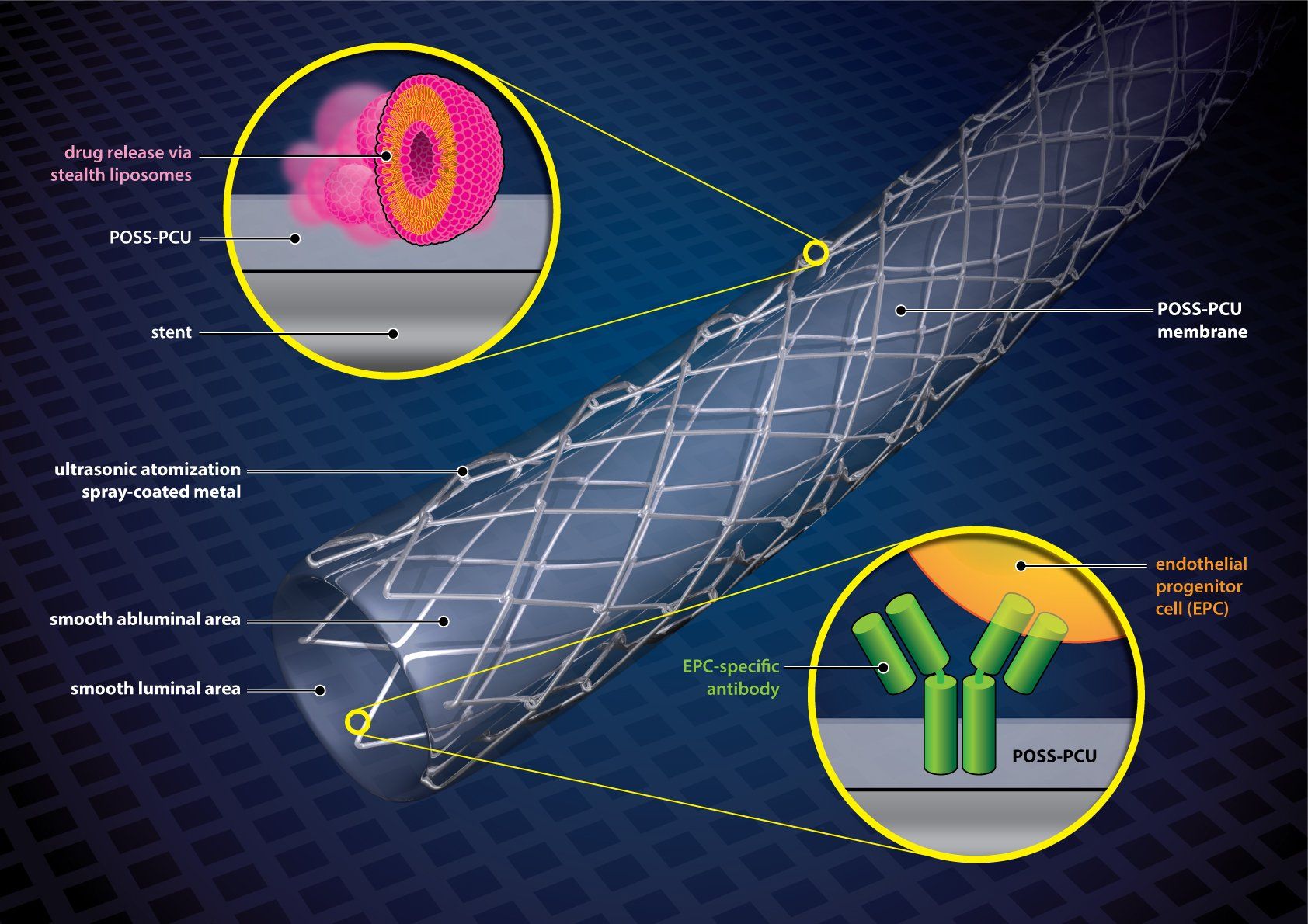 coated stent 3d model