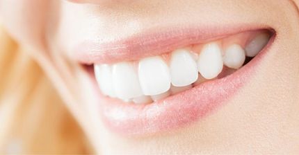 brilliant white smile The work of our dentist in Adelaide