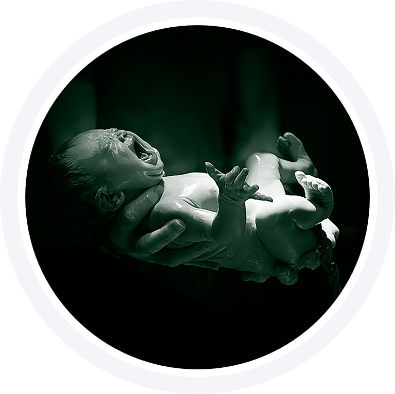 Antenatal Classes Alice Springs