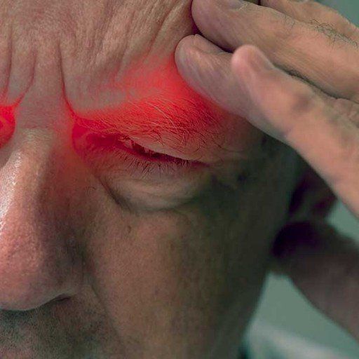 Vestibular Rehabilitation