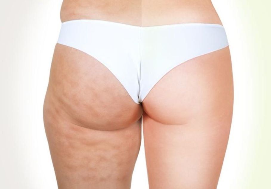 TRATTAMENTO CORPO