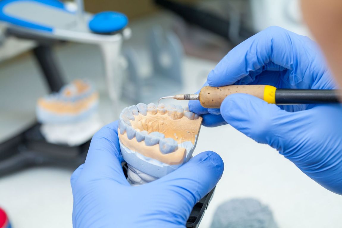 Impronta dentale