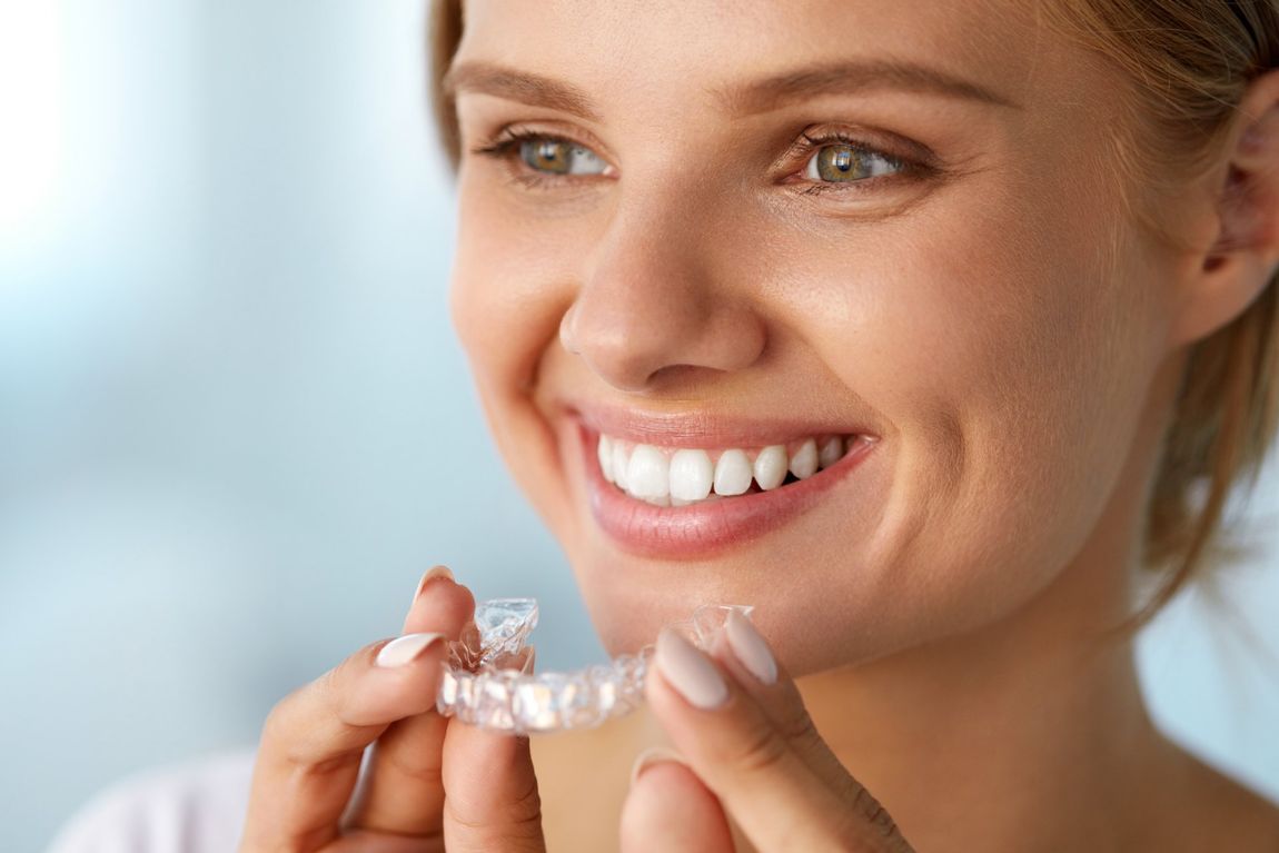mascherina trasparente per i denti