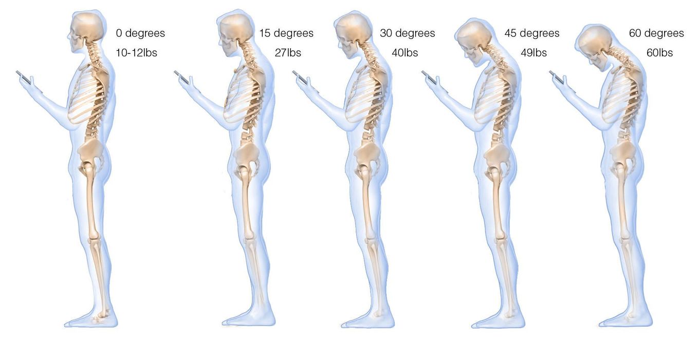 head forward posture