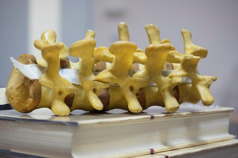 Lumbar — Lumbar Spine Model in Bakersfield, CA Lumbar — Lumbar Spine Model in Bakersfield, CA