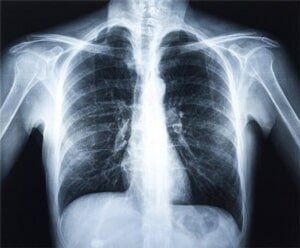 X-ray - Chiropractic Maintenance in Urbana IL X-ray - Chiropractic Maintenance in Urbana IL