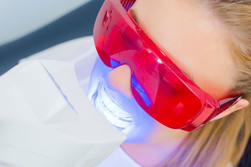 Weiße Zähne in ein bis zwei Stunden mit Power-Bleaching beim Zahnarzt! Weiße Zähne in ein bis zwei Stunden mit Power-Bleaching beim Zahnarzt!