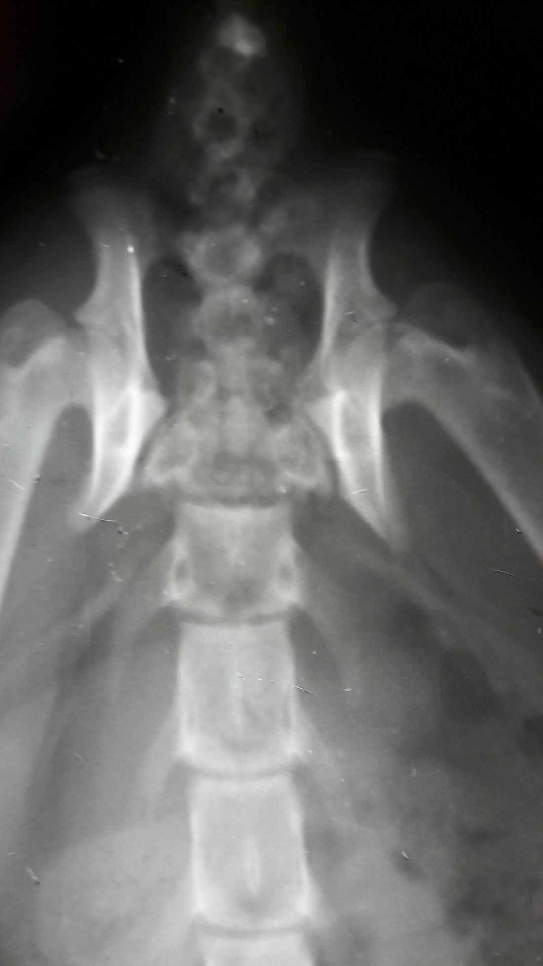radiografia