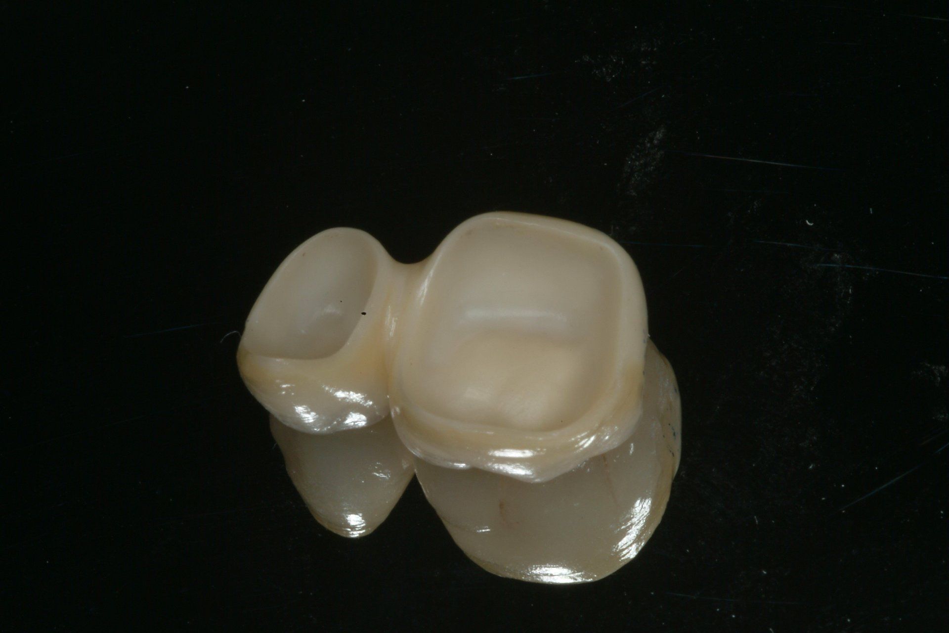 denti rovinati
