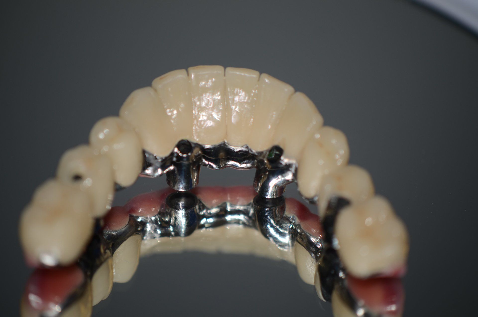 applicazione di apparecchio su denti di paziente