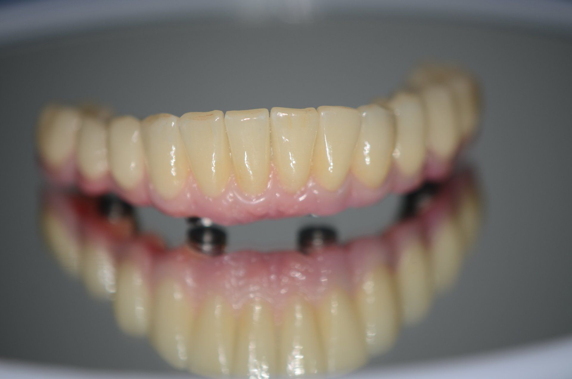 denti a incastro