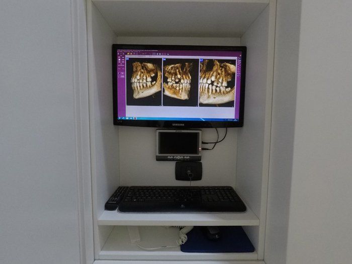 radiografia apparato dentale