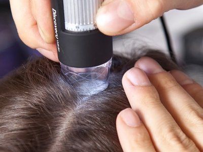 analisi del cuoio capelluto