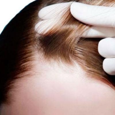 cuoio capelluto di una ragazza