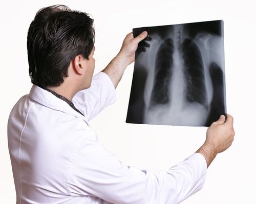 Doctor reviewing x-ray Doctor reviewing x-ray