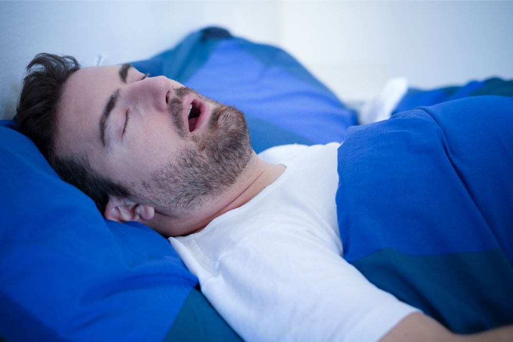 apnea notturna