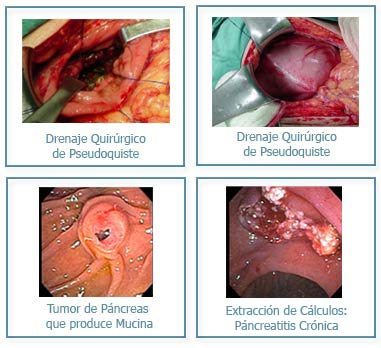 DIGECLINIC / DR. MICHAEL VITALE - Endoscopía avanzada