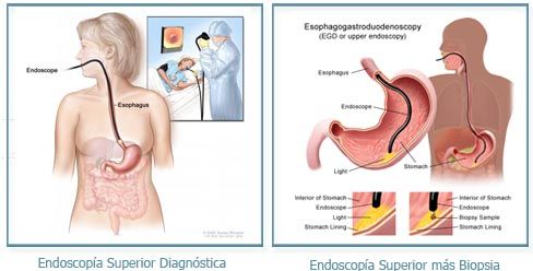 DIGECLINIC / DR. MICHAEL VITALE - Diagnostico de reflujo gastroesofágico